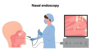Nasal Endoscopy Doctor in Dwarka