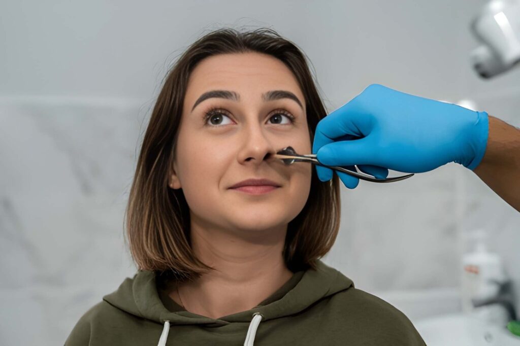 Nasal Endoscopy Doctor in Dwarka